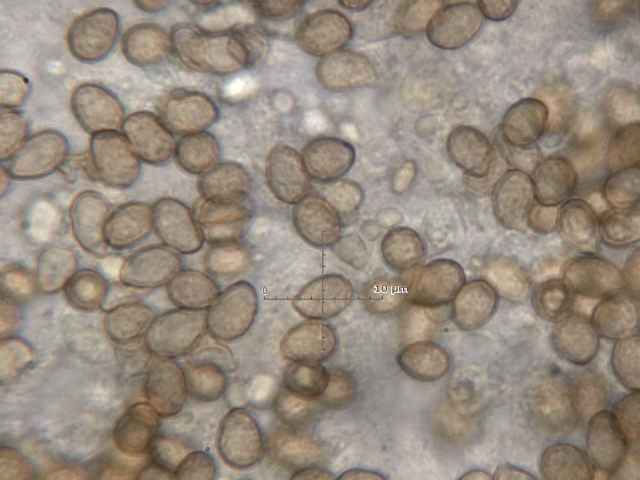 Un Phlegmacium